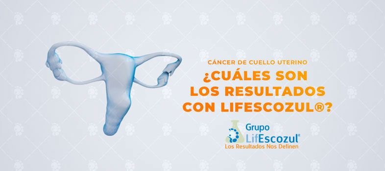 Cáncer de cuello uterino
