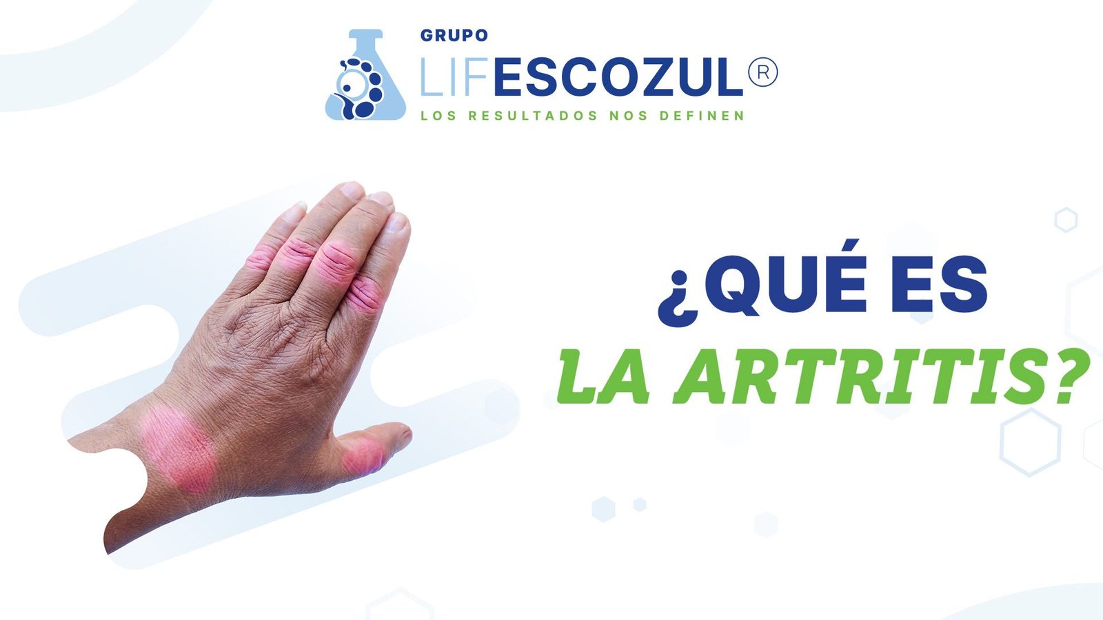 que-es-la-artritis-grupo-lifesczozul